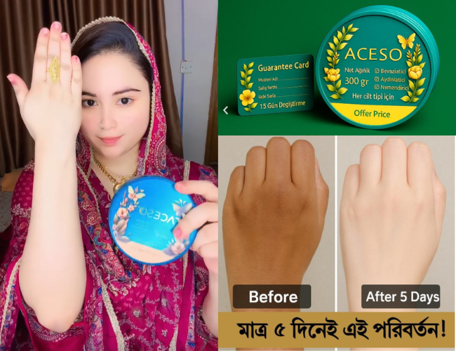 ACESO Body Whitening Cream